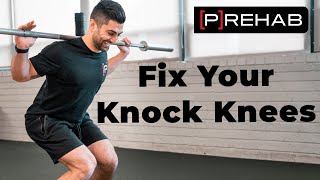 Fixing Your Knock Knees With Two Exercises