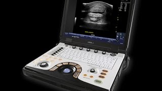 Logiq™ e NextGEN Equine Ultrasound System