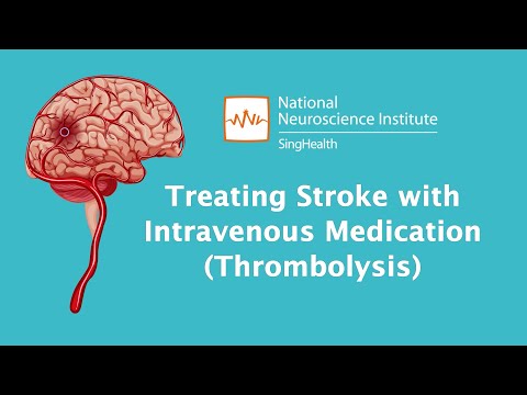 Understanding stroke: treating stroke with thrombolysis