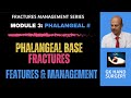 Phalangeal base fractures: Features and management