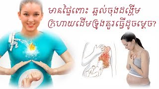 មានផ្ទៃពោះឆ្អល់ចុងដង្ហេីម ក្រហាយដេីមទ្រូងគួរធ្វេីដូចម្ដេច GERD in pregnancy by Dr.Bun laysophea