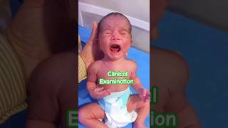 Neonatal Reflexes test /clinical Examination #medicalstudent #ytshorts #trending #trending #shorts