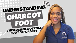 Understanding Charcot Foot: The Rocker-Bottom Foot Deformity #charcotfoot #diabeticfoot #neuropathy