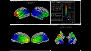 MVPA Visualization