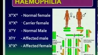 Matric revision: Life Sciences: Genetics (4/5): Sex chromosomes, sex and x-linked disorders