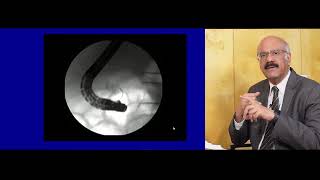 ERCP basics part 2