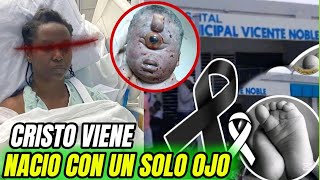 INCREÍBLE: EL MUNDO ESTA ATERRADO TRAS EL NACIMIENTO DE UN NIÑOS CON UN SOLO OJO EN VICENTE NOBLE