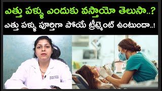 ఎత్తు పళ్ళు ఎందుకు వస్తాయో తెలుసా | ఎత్తు పళ్ళు పూర్తిగా పోయే ట్రీట్మెంట్ ఉంటుందా | Dr.Revathi | HQ