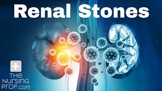 Renal (Kidney) Stones