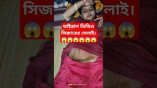 সিজারের সেলাই কাটার সঠিক নিয়ম#youtubeshorts #shortvideo #সিজার#caesars #operation #baby #shorts