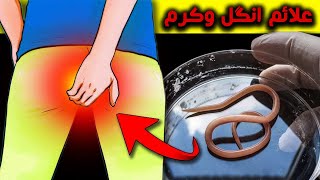 علائم و نشانه هایی که از کرم روده خبر می دهد