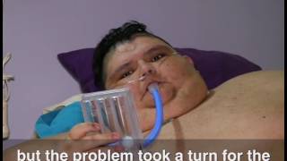 World's heaviest man recovers from bypass surgery