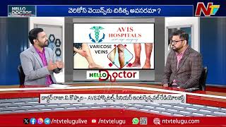 Varicose Veins: Symptoms and Treatment | AVIS Hospitals | Dr. Rajah V Koppala l Hello Doctor l Ntv