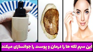 سرم جوانسازی و روشن کننده پوست مخصوص تمام انواع پوست/ساخت یک سرم عالی برای پاک کردن جوشها و لک وپیس