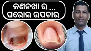 କଣନଖା ର ଘରୋଇ ଉପଚାର | Nail Infection Home Remedies | Nail Fungal Infection | Nail Odia Upachar |