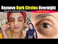 My Friend Told me a Remedy 😱 Remove Dark Circles Fast 100% Permanently at Home