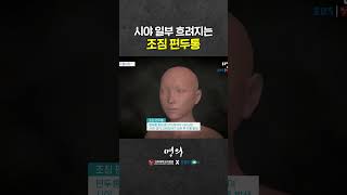 편두통 환자 20%는 조짐 편두통