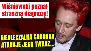 WIŚNIEWSKI POZNAŁ PRZERAŹLIWĄ DIAGNOZĘ!  NIEULECZALNA CHOROBA „ATAKUJE JEGO TWARZ”