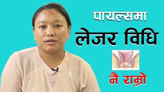 लेजरबाट पायल्सको अपरेसन Piles operation latest technology II BNB Laser clinic Pokhara, Laser