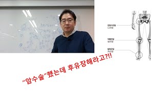 암수술 했는데 후유장해라고? 후유장해보험 마스터