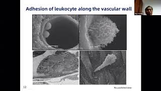 3.The advantage of TCM in treating febrile: discussion on the mechanisms in treating COVID-19 cases