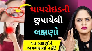 થાયરોઇડની છુપાયેલી લક્ષણો | આ લક્ષણોને અવગણશો નહીં! | Dry Eyes \u0026 Thyroid | Dr. Tanvi Mayur Patel