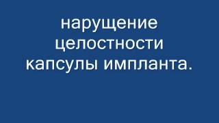 Нарушение целостности капсулы импланта молочной железы.