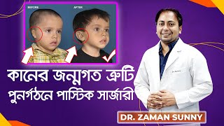 কানের ত্রুটি পুনর্গঠনে প্লাস্টিক সার্জারী। Dr.Zaman Sunny