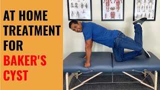 4 Self Treatments For Baker’s Cysts In The Knee