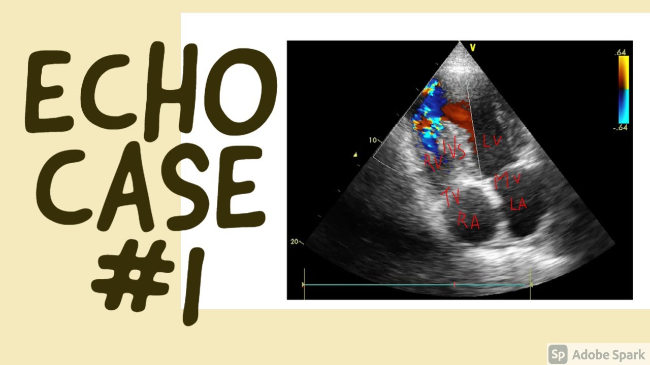 Case Journal Echo At Katherine Edmunds Blog