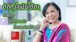 ตัดถุงไขมันใต้ตา  ทำแค่ตาแต่ได้ถึง 2 เด้ง  ทั้งตาและร่องแก้ม