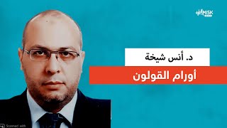 أورام القولون مع د. أنس شيخة - دكتور مسك مع فاتن أبو قبع