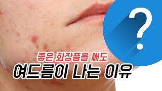 좋은 화장품을 써도 여드름이 나는 이유