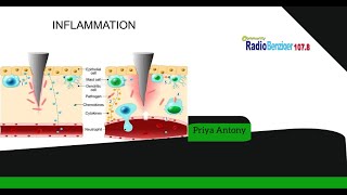 സുഖിനോ ഭവന്തു | Inflammation |നീർ വീക്കം | യോഗവിദ്യ പരിചയപ്പെടുന്നു - Priya Antony | Radio Benziger