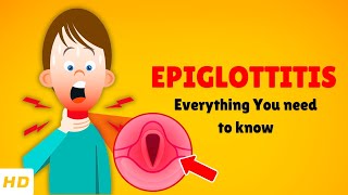 Epiglottitis – Causes, Signs and Symptoms, Diagnosis \u0026 Treatment