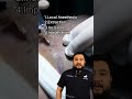 hair transplant surgery steps how is fue applied