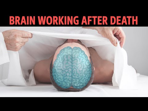 How long does it take for brain to die?