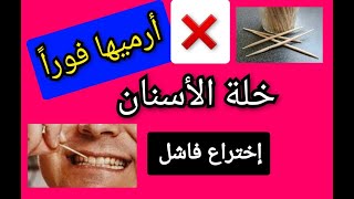 خلة الأسنان إختراع فاشل له أضرار على الاسنان و اللثة Toothpicks  ارميها فوراً و إليك البدائل