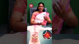 அல்சர் இருப்பதற்கான அறிகுறிகள் | ulcer reason in stomach | ulcer symptoms | ASK