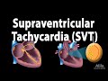 Supraventricular Tachycardia (SVT, PSVT), Animation