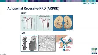 Basics of clinical care for children with ARPKD and ADPKD