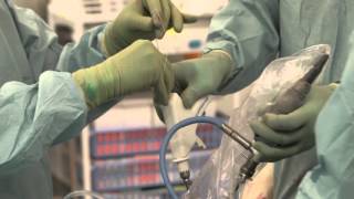 Medial Meniscal Repair Using The SharpShooter Meniscal  Repair System