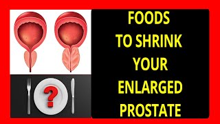 Best Foods to Eat with Enlarged Prostate| Shrink Your Enlarged Prostate