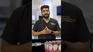 🔬 Dr. Dilip Kumar Explains: Discover the World of Gum Surgery! 💉