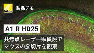 Mouse Brain captured by Nikon confocal microscope A1 HD25