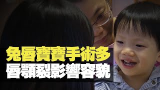 TVB News 兔唇寶寶手術多 唇顎裂影響容貌 (最強生命線 黃靖婷 TVB News) bji 2.1