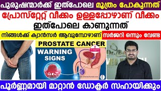 പുരുഷന്മാർക്ക് ഇത് പോലെ മൂത്രം പോകുന്നത് പ്രോസ്റ്റേറ്റ് വീക്കം ഉള്ളപ്പോഴാണ് ഇത് പോലെ കാണുന്നത്