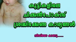 കുട്ടികളിലെ ചിക്കന്‍പോക്സ്... Chickenpox in children