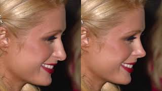 Dr Bader NOSE Hollywood, episode 4: Paris Hilton
