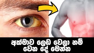 ඔබේ අක්මාව ලෙඩ වෙලානම් හගවන ලක්ෂණ